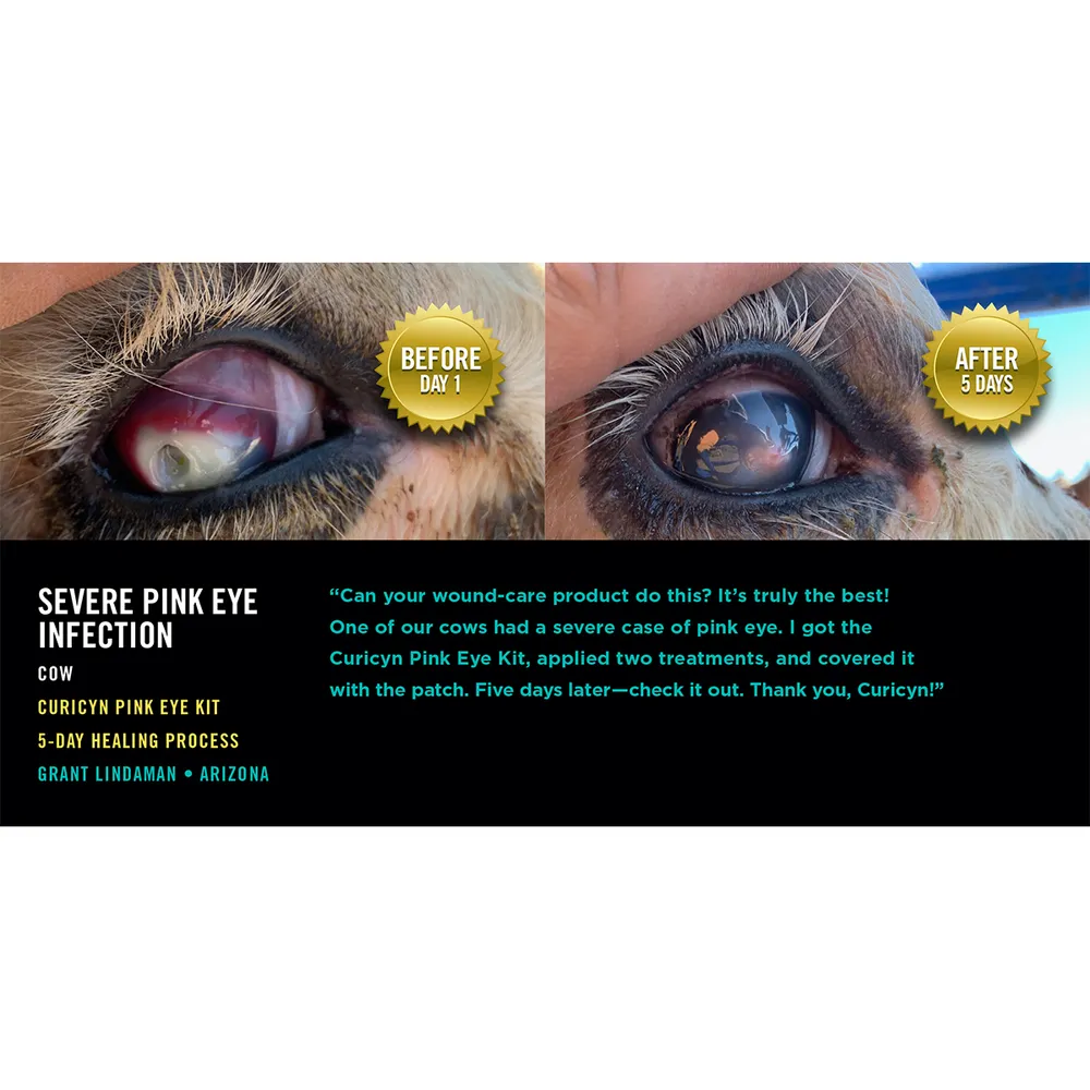 Curicyn Pink Eye Kit 6 Curicyn Pink Eye Kit - Image 4